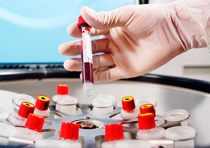 Sonicer Gt|Perfil Lipídico